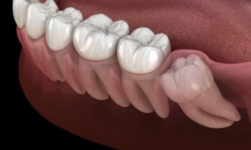 image6
